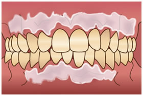 ���Ò��̒ɂ݂ɂ���