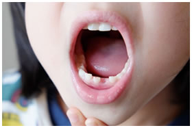 �i�v���ւ̐����ς��